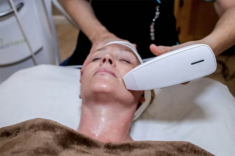 Everything You Need to Know About the IPL Venus Versa Treatment